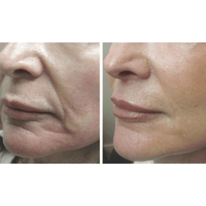 МИКРОТОКОВЫЙ ЛИФТИНГ-МАССАЖЕР ДЛЯ ТЕЛА MEDICA+ SKIN LIFTING 5.0 ЯПОНИЯ фото № 14
