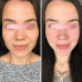 EMS МИКРОТОК MEDICA+ ЛИФТИНГ-МАССАЖЕР для лица SKIN LIFTING 6.0 PINK (ЯПОНИЯ) фото № 9