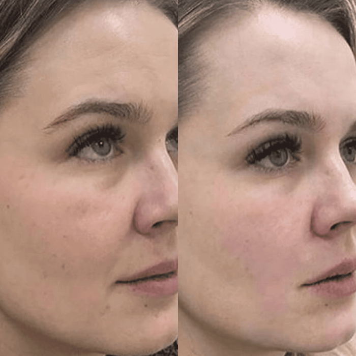 Увлажняющий гель Medica+ Hydration Gel фото № 12