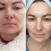 Успокаивающая маска для лица Medica+ Soothing Mask фото № 10