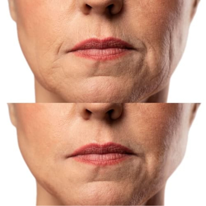 Набор Микротоковый RF Lifting Массажер для лица Skin Lifting 7.0 White + Токопроводящий гель + Успокаивающая маска для лица Medica+ фото № 7