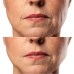 Набор Микротоковый RF Lifting Массажер для лица Skin Lifting 7.0 White + Токопроводящий гель + Успокаивающая маска для лица Medica+ фото № 7
