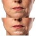 Набір Мікрострумовий RF Lifting Масажер для обличчя Skin Lifting 7.0 Pink + Провідний гель + Маска для обличчя, що розширює пори Medica+ фото № 9