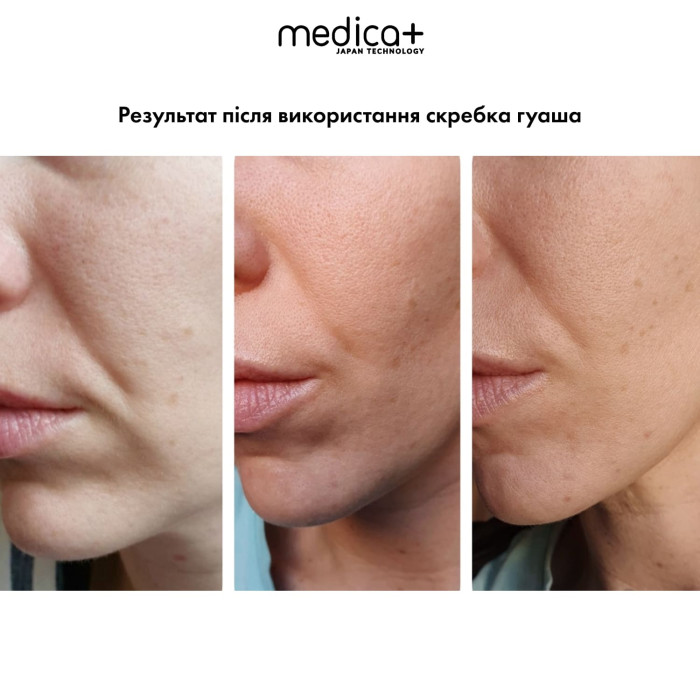 Стальной скребок для моделирования овала лица MEDICA+ Steel GuaSha фото № 4