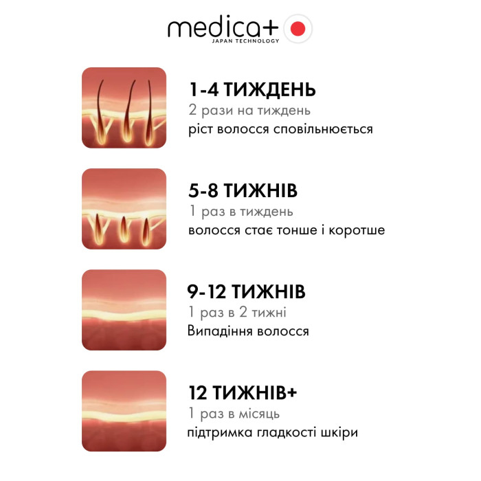 Набір для фотоепіляції MEDICA+: Фотоепілятор 8.0 + Захисні окуляри + Флюїд після епіляції фото № 6