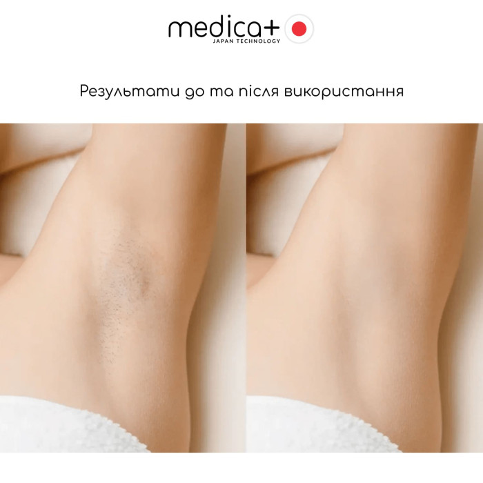 Набір для фотоепіляції MEDICA+: Фотоепілятор 8.0 + Захисні окуляри + Флюїд після епіляції фото № 9