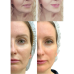 Мікрострумовий RF Lifting Масажер для обличчя Skin Lifting 7.0 Pink - EMS, LED фото № 5