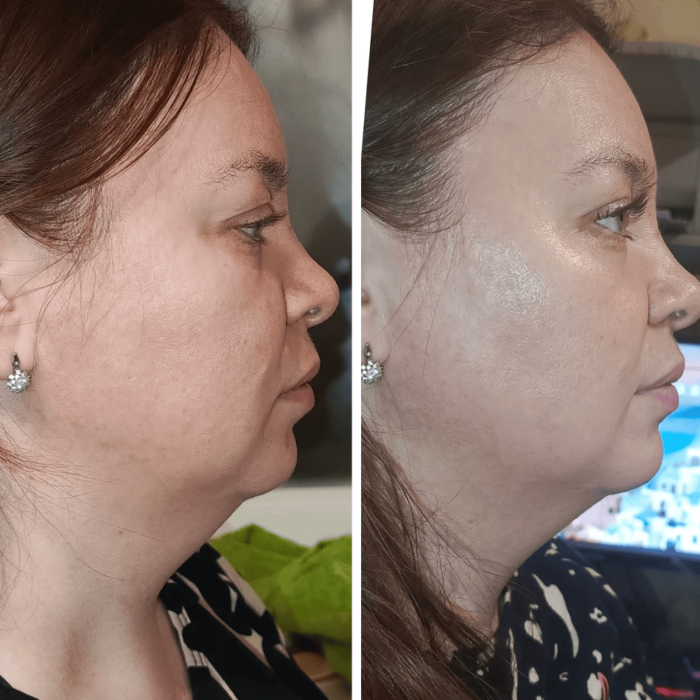 Мікрострумовий RF Lifting Масажер для обличчя Skin Lifting 7.0 Pink - EMS, LED фото № 7