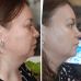 Мікрострумовий RF Lifting Масажер для обличчя Skin Lifting 7.0 Pink - EMS, LED фото № 7